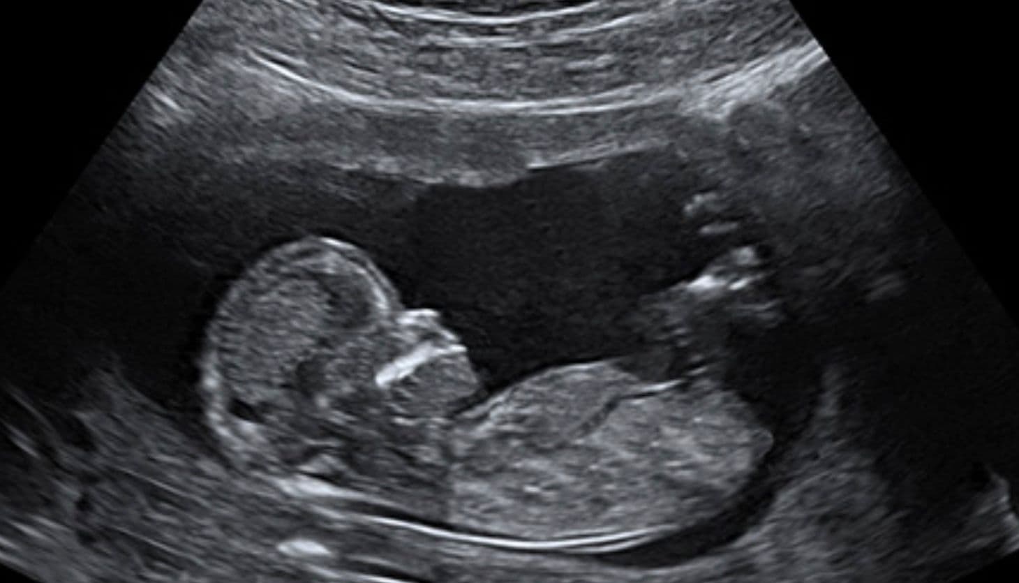 Post image - The Expensive Affair_SEX